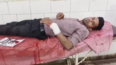 डूंगरपुर: साबेला बाईपास मार्ग पर बाइक सवार 6 बदमाशों ने शराब के ठेका कर्मचारी के साथ पथराव और मारपीट की घटना को अंजाम दिया