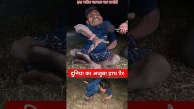 दुनिया का अजूबा आदमी हाथ पैर देखिये!! #shorts #divyang #ajuba #trend #handmade #viralvideo #reels