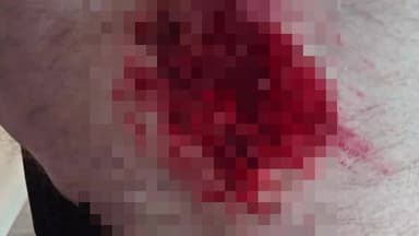 মন্দিরবাজার: মন্দিরবাজার এর ঘাটেশ্বর এলাকায় বাইক ও সাইকেলের সংঘর্ষে আহত সাইকেল আরোহী