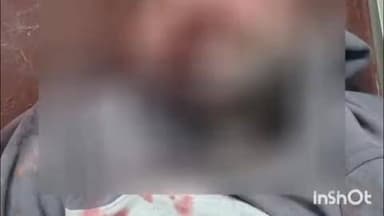 तुरकौलिया: सेमरा में अज्ञात वाहन की ठोकर से 29 वर्षीय युवक की हुई मौत, रविवार को पुलिस ने शव परिजनों को सौंप दिया