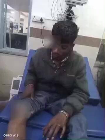 पंडरिया: गोरियापारा में तेज रफ्तार बाइक में सवार दो व्यक्ति अनियंत्रित होकर सड़क किनारे गिरे, पंडरिया अस्पताल में भर्ती