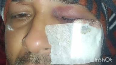 हापुड़: मोहल्ला कन्हैयापुरा में बच्चों के विवाद के चलते हुई मारपीट, 1 महिला समेत 4 लोग घायल