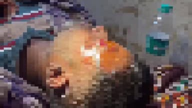 গোসাবা: রাধানগরে বাইকের ধাক্কায় গুরুতর আহত যুবককে কলকাতার হাসপাতালে নিয়ে যাওয়া হলো সোমবার রাত ২টায়