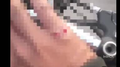 महू किशनगंज रेलवे ब्रिज पर युवक का हाथ कटा, एसडीएम ने कड़ी कार्रवाई की बात कही