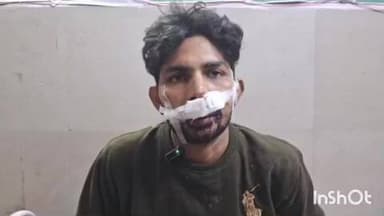 नकुड: गुलाम ओलिया में पैसे के लेन-देन में हुई मारपीट, 3 लोग हुए घायल