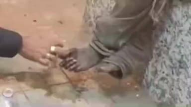 ফলতা: বঙ্গ নগর এলাকার কাছে পথ দুর্ঘটনায় আহত হয় এক ভবঘুরে ব্যক্তি স্থানীয়দের উদ্যোগে করা হয় চিকিৎসা।