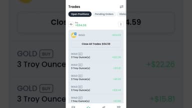 today global market live trading✨ #tredingshorts #profit