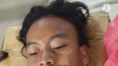 নগাঁও: নগাঁও মেডিকেল কলেজ হস্পিতালত ভৰ্তি খেৰনিত গুলীবিদ্ধ পিনঠি তিমুং,সোঁভৰিত গুলী লাগিছে পিনঠি তিমুঙৰ