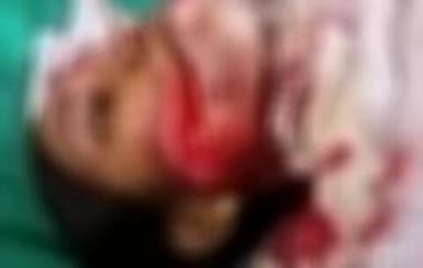 माहूर: बामनगुडा येथील महिलेवर शेतात बिबट्याने नव्हे तर अस्वलाने केला हल्ला - वनविभागाने दिली माहिती