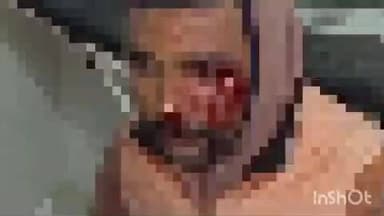 जमुई: लक्ष्मीपुर के युवक को सड़क दुर्घटना में लगी चोट, दिग्विजय सिंह सामुदायिक स्वास्थ्य केंद्र में किया गया प्राथमिक उपचार