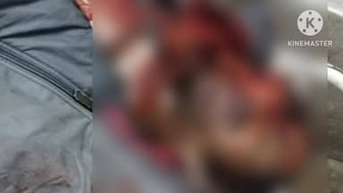 পুরুলিয়া ২: বাইক থেকে পড়ে মৃত্যু ব্যক্তির, ময়নাতদন্তে দেহ পাঠানো হয় পুরুলিয়া মেডিকেলের মর্গে