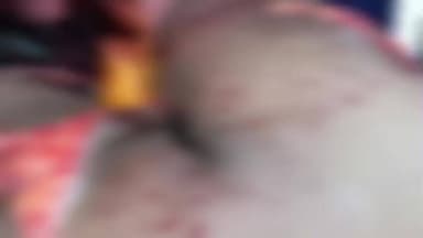 கொடைக்கானல்: காட்டு மாடு முட்டி பெண் படுகாயம் K.C.பட்டி அருகே பரிதாபம்