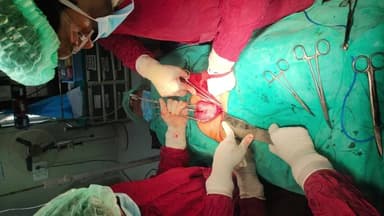 ధర్మారం: అత్యాధునిక ఆపరేషన్ చేసి గడ్డలు తొలగించిన పెద్దపల్లి ప్రభుత్వ ఆసుపత్రి వైద్య సిబ్బంది