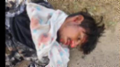 రాయదుర్గం: కళ్యం వద్ద ద్విచక్ర వాహనం అదుపుతప్పి బోల్తా పడిన ఘటనలో ఒక యువకుడికి తీవ్ర గాయాలు, ఆసుపత్రికి తరలింపు