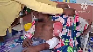 গোলাঘাট: নুমলীগড়ত নাহৰফুটুকীৰ বাঘৰ আক্ৰমণত গুৰুতৰভাৱে আহত যুৱকক শ্বহীদ কোশল কোঁৱৰ অসামৰিক চিকিৎসালয়ত ভৰ্তি