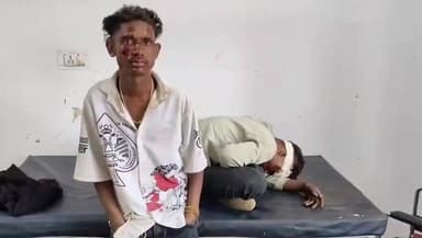 डिंडौरी: बूडरूखी गांव में मोटरसाइकिल दुर्घटना, दो युवक घायल, अस्पताल में उपचार जारी