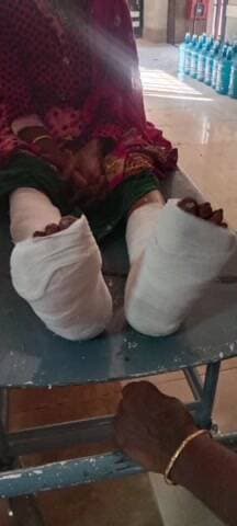 તિલકવાડા: કામસોલી ટેકરા પાસે ફોરવીલ ગાડી એ એક બકરીને પરફેક્ટ લેતા બકરીનું ઘટના સ્તરે મોત એક મહિલાને બને પગના ભાગે ફેક્ચર કરી ફરાર.