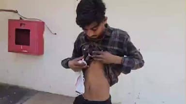 वैजापूर: बिबट्याच्या हल्ल्यात तरुण जखमी, माळीसागज येथील घटना