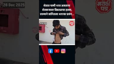 Vaijapur ||शेतात पाणी भरत असताना शेतकऱ्यावर बिबट्याचा हल्ला,तरुणाने सांगितला थरारक प्रसंग...