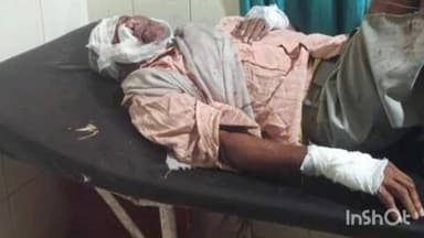 भितरवार: शासन पेट्रोल पंप के पास बाइक चालक ने राहगीर बृद्धि को मारी टक्कर, राहगीर घायल