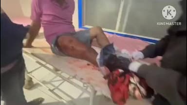 देवास नगर: चाणक्यपुरी मल्टी क्षेत्र में अज्ञात बदमाशों ने दो युवकों के साथ की मारपीट