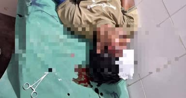 बोलबा: मोटरसाइकिल की टक्कर में दो लोग गंभीर रूप से घायल