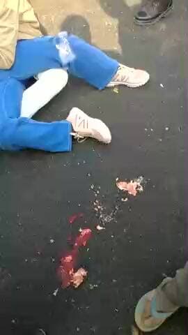 nedula chauraha ke aage sabji mandi ke gate ke aage hua a accident hua 2 jan 2026 1:20
sant kabir nagar