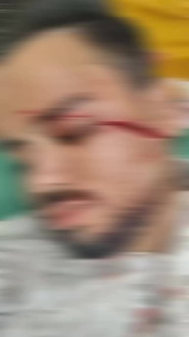 હિંમતનગર: રાધીવાડ હાઇવે પર પતંગની દોરીથી ટુ-વ્હીલર ચાલક ઘાયલ