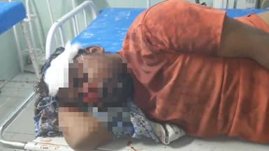 అచ్చంపేటలో అన్నదమ్ముల మధ్య ఘర్షణ,తమ్ముడికి తీవ్ర గాయాలు