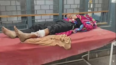 अमरोहा: अमरोहा में मासूम के साथ दरिंदगी करने वाले दरिंदे को पुलिस ने पैर में गोली मारी, जिला अस्पताल में भर्ती