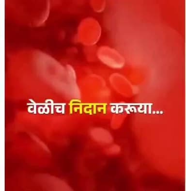 नांदेड -सिकल सेल ॲनिमिया विशेष अभियान 15 जानेवारी ते 7 फेब्रुवारी 2026