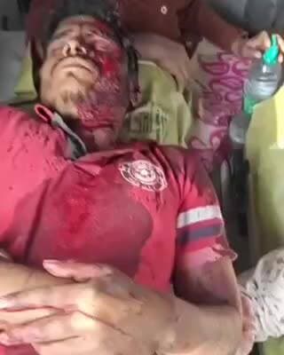 టేక్మల్: దాదాయిపల్లిలో పొలం విషయంలో ఒకరి పైన ఒకరు గొడ్డలితో దాడులు