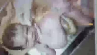 उतरौला: उतरौला तहसील अंतर्गत चमरूपुर के एक निजी अस्पताल में एक महिला ने चार हाथ और तीन पैर वाले बच्चों को दिया जन्म