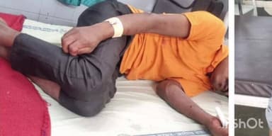 दापोली: पंचनदी कोळथरे परिसरात पिसाळलेल्या कुत्र्याचा धुमाकूळ, 6 नागरिकांना कुत्र्याचा चावा