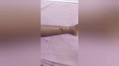 புரசைவாக்கம்: கார்பைடன் காலனியில் 10 வயது சிறுவனை கடித்த வளர்ப்பு நாய் காவல் ஆணையர் அலுவலகத்தில் தந்தை புகார்