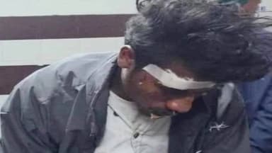 पेटरवार: भेलवांटांड में स्कूटी सवार युवक सड़क दुर्घटना में घायल, अस्पताल में भर्ती