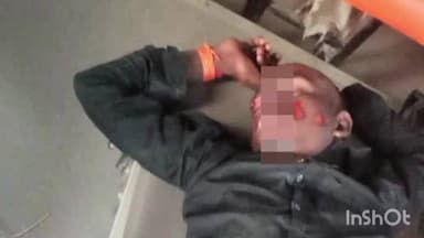 रमकंडा: रमकंडा-भंडरिया मार्ग पर दो बाइकों की टक्कर, एक व्यक्ति गंभीर रूप से घायल