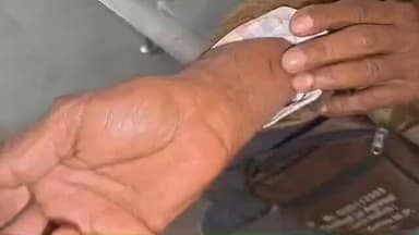 मानिकपुर: जमीनी विवाद में 2 पक्षों के बीच लाठी-डंडे चले, कुल्हाड़ी से 1 घायल, मारकुंडी पुलिस ने स्वास्थ्य परीक्षण कराया