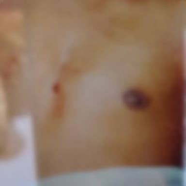 नरवल: तीन दिन बाद हत्या के शक में नजफगढ़ गंगा घाट से कब्र खोदकर निकाला गया शव