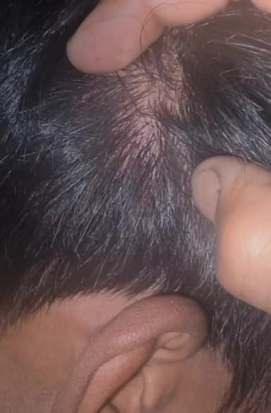 घरघोड़ा: बरौद माइंस क्षेत्र में नशे में धुत युवक ने पानी टैंकर चालक पर किया जानलेवा हमला