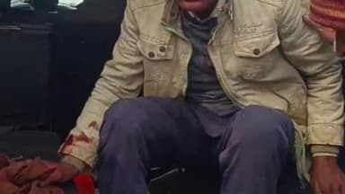 जतारा: दो बाइकों की आमने-सामने भिड़ंत, दोनों बाइक चालक घायल, जतारा सीएचसी से जिला अस्पताल रेफर