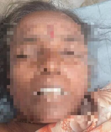 ಚನ್ನಪಟ್ಟಣ: ಮಹಿಳೆಗೆ ಕಾರು ಡಿಕ್ಕಿ ಮಹಿಳೆ ಸಾವು, ಶೇರ್ವ ಹೋಟೆಲ್ ಬಳಿ ಘಟನೆ