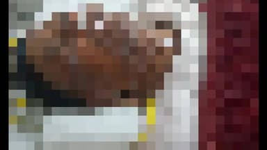 नोआमुंडी: ड्यूटी निभाते समय डालसा के पीएलवी दिल बहादुर दुर्घटना का शिकार हुए