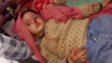 रामपुर मनिहारन: रामपुर मनिहारान में आवारा कुत्ते का आतंक, दो मासूम बच्चों पर हमला, गंभीर घायल, गांव में दहशत का माहौल