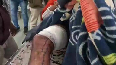 छतरपुर नगर: ग्राम दोनी में युवक ने खुद को पैर में मारी गोली, ज़िला अस्पताल में भर्ती