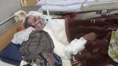 शिकोहाबाद: खैरगढ़ के प्रतापपुर में खौलते पानी की चपेट में आकर ग्रामीण गंभीर रूप से झुलस गया, इलाज जारी