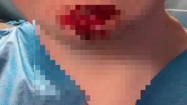 মন্দিরবাজার: লক্ষীকান্তপুর এলাকায় বাইক ও ভ্যান এর সংঘর্ষে আহত বাইক আরোহী