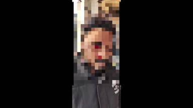 ਆਨੰਦਪੁਰ ਸਾਹਿਬ: ਅਨੰਦਪੁਰ ਸਾਹਿਬ ਦੇ ਨਜ਼ਦੀਕੀ ਮਹੱਲਾ ਲੋਹਗੜ ਵਿਖੇ ਮੋਟਰਸਾਈਕਲ ਤੇ ਜਾ ਰਿਹਾ ਨੌਜਵਾਨ ਚਾਈਨਾ ਡੋਰ ਦੀ ਲਪੇਟ ਵਿੱਚ ਆਣ ਕਾਰਨ ਹੋਇਆ ਜ਼ਖਮੀ