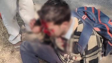 सहसपुर लोहारा: ग्राम नरोधी चौक में एक व्यक्ति अपने बाइक से गिरकर गंभीर रूप से घायल, लोहार अस्पताल में कराया भर्ती