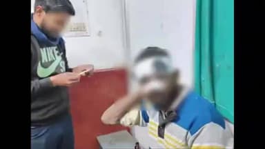 फतेेहपुर: फतेहपुर-देवा मार्ग पर तेज रफ्तार बाइक ने 22 वर्षीय युवक को मारी टक्कर, सड़क पार करते समय गंभीर रूप से घायल